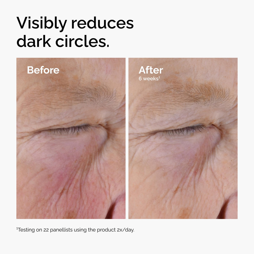 The Ordinary Caffeine Solution 5% + EGCG, Depuffing Eye Serum for Dark Circles and Tired Eyes, 1 Fl Oz